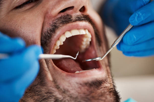 Best Emergency TMJ Treatment in Bel Air South, MD